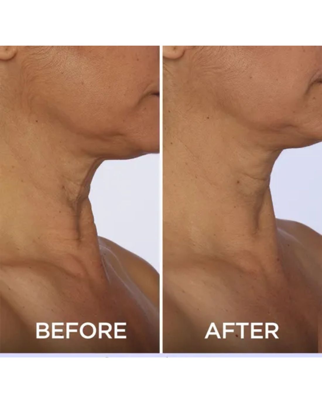 GoPure - Crema Reafirmante para el Cuello