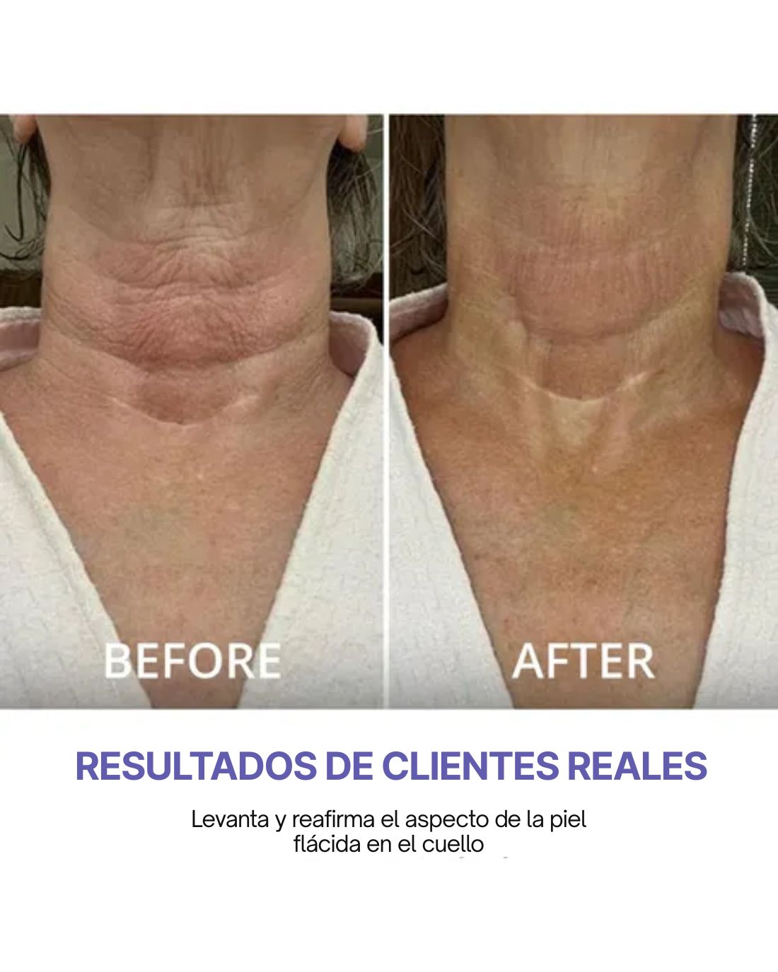 GoPure - Crema Reafirmante para el Cuello