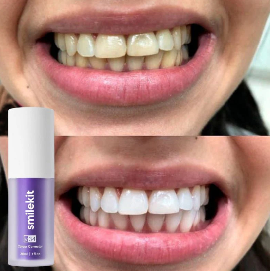 Espuma Blanqueadora SmileKit