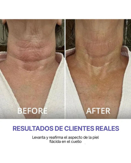 GoPure - Crema Reafirmante para el Cuello
